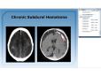 2016 BH Critical Care Class: Neuro 1